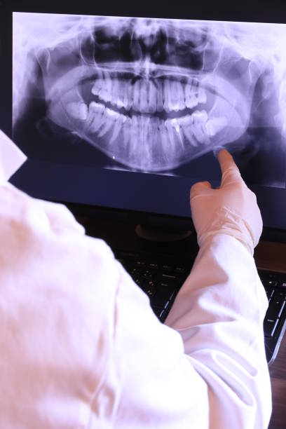 Best Emergency Dentist for Lost Fillings or Crowns in Cliffwood Beach, NJ