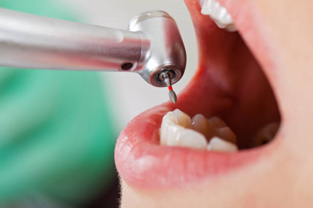 Best Broken or Cracked Tooth Emergency Dentist in Cliffwood Beach, NJ